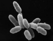 Halobacteria sp. strain NRC-1. Each cell is some 5 microns in length